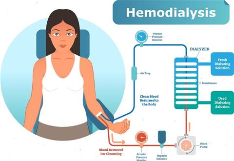 Hemodialysis System