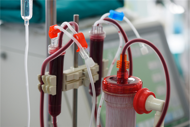 Fluid Management in Hemodialysis.